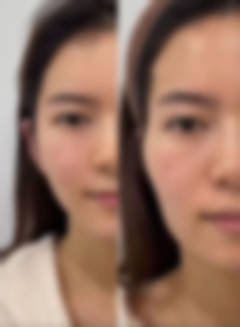 瘦脸针白毒怎么样