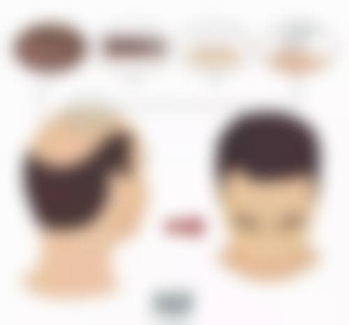 一年打一次除皱针对皮肤有伤害吗