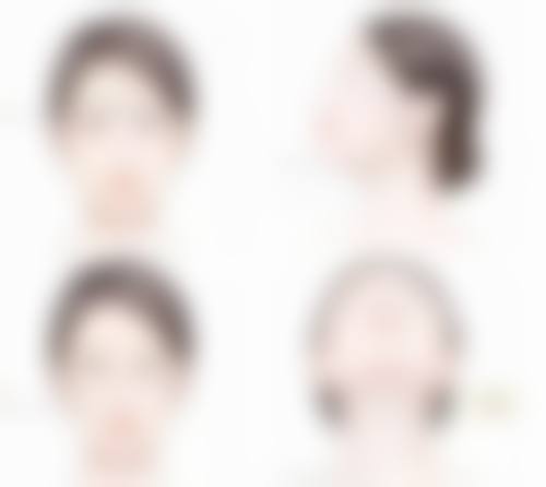 种植头发以后还会掉吗图片