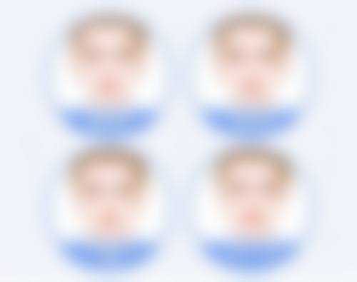 成人张嘴睡觉导致凸嘴的矫正