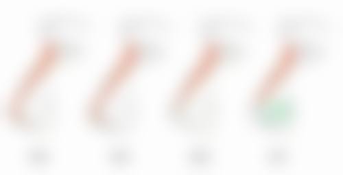 瘦脸针打几次可以定型