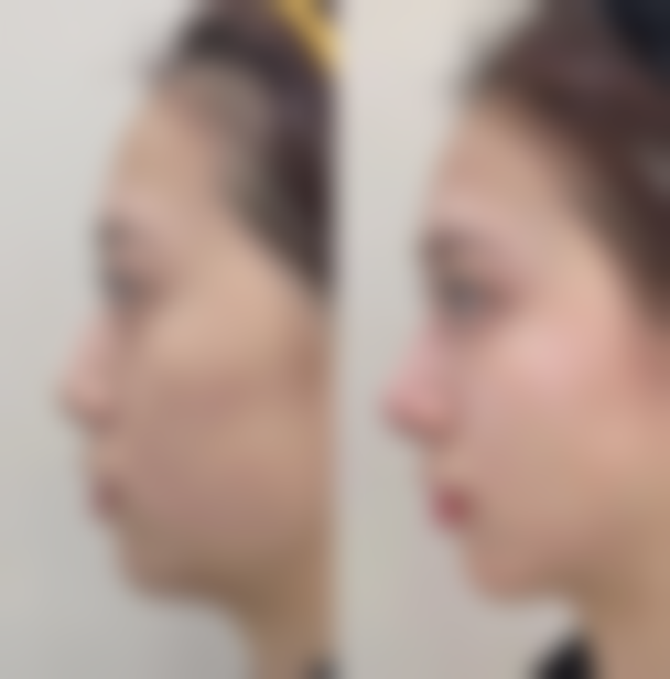 【朴光珉医生技术特点：】