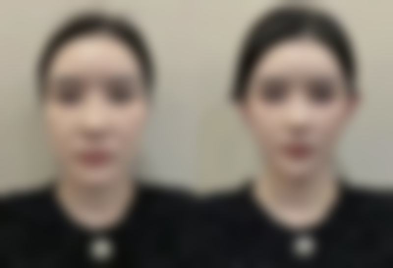 【胡晓焕医生口碑怎么样？】