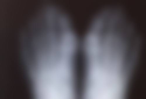 种植秃顶大概要多少钱