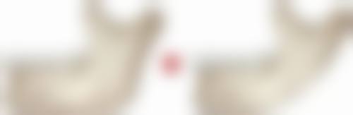 五、除皱针一年打几次更好