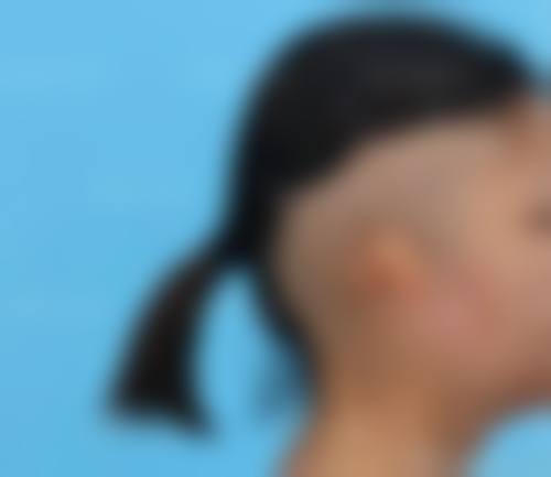 评价三：“我做了面部填充项目，成效超出了我的预期。填充后脸部变得饱满了，皱纹也少了特别多，看起来年轻了好几岁。医院的医护人员都特别热情，让我在整个过程中都特别安心。以后有需要还会再来的。”