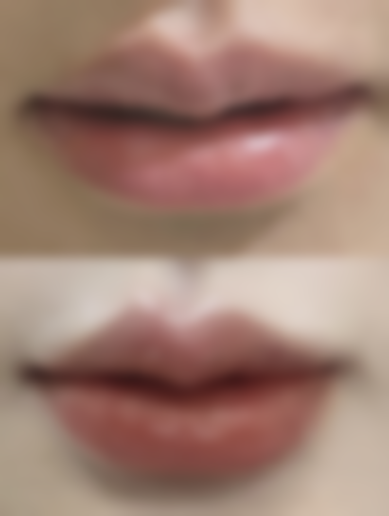 【银川市兴庆区慧顶医学美容诊所患者口碑评价：】