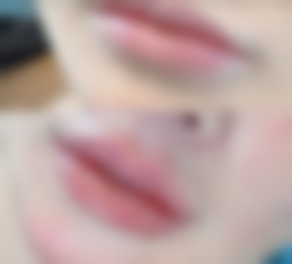 四、除皱针哪个牌子成效好