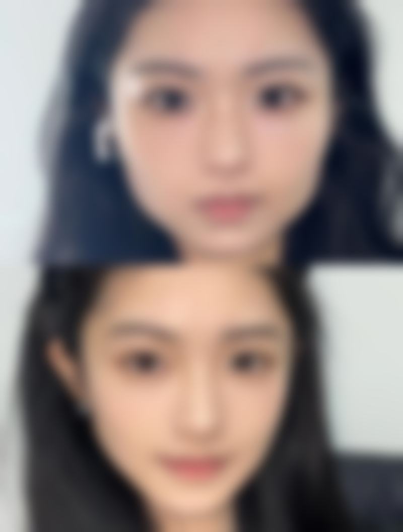 如果选择乘坐公共交通，大家可以选择到达鲤鱼山路附近的公交站，具体的乘车线路可以根据当地公交查询。这样即使没有私家车，也能特别方便地到达医院。