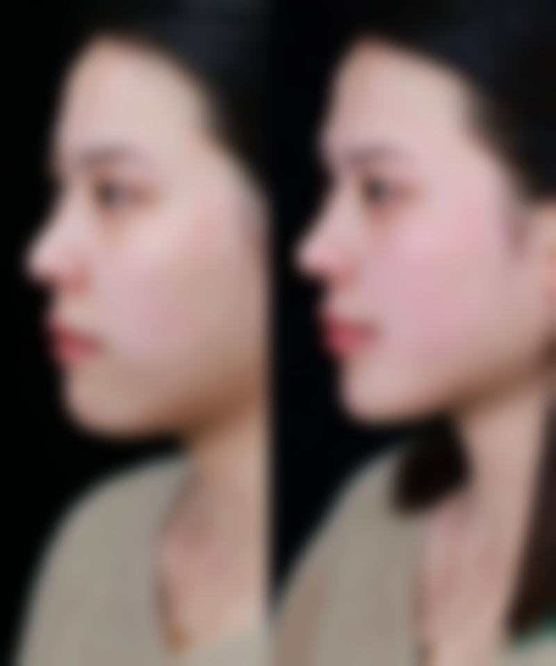 【无锡乔森整形医院地址：】