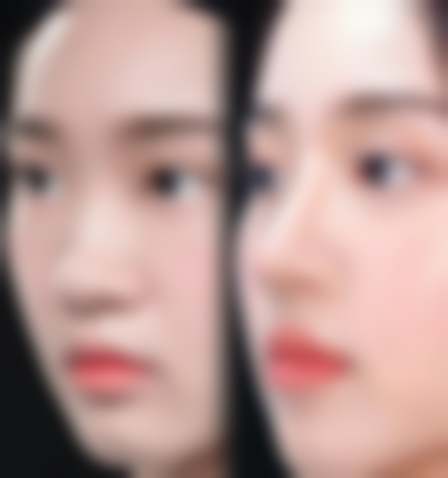 七、除皱针可以维持多长时间