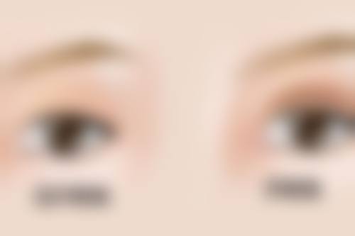 瘦脸针在哪里打