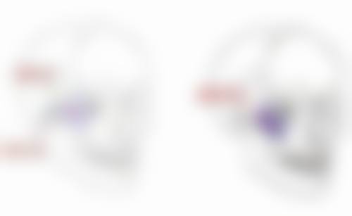 法令纹打除皱针好还是玻尿酸好