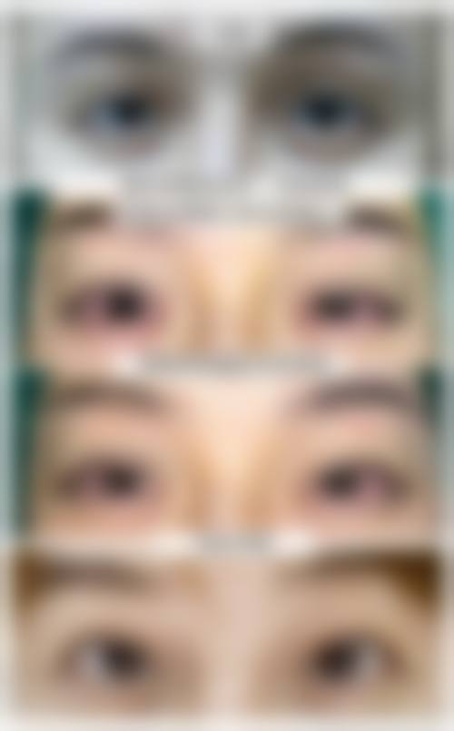 【朝阳康韵整形医院参考价格表：】