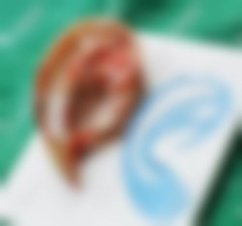 【朝阳康韵整形医院地址：】