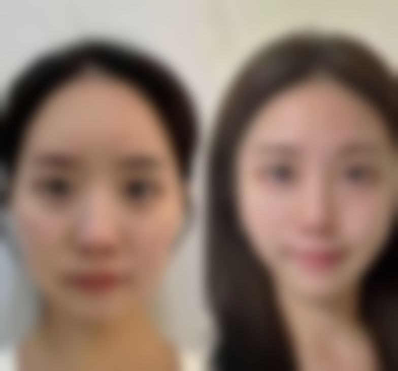 【合肥伊尔美整形美容机构是正规的吗?】