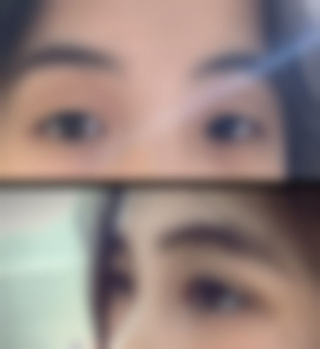 【夏华光医生擅长项目】