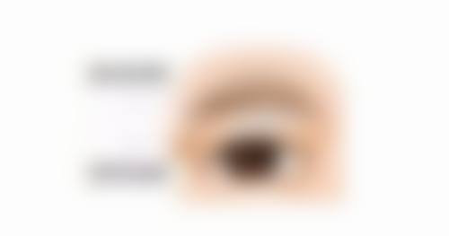 针灸除皱后能保持多久