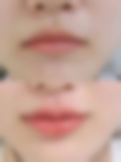 【宸山医疗美容集团怎么预约挂号?】