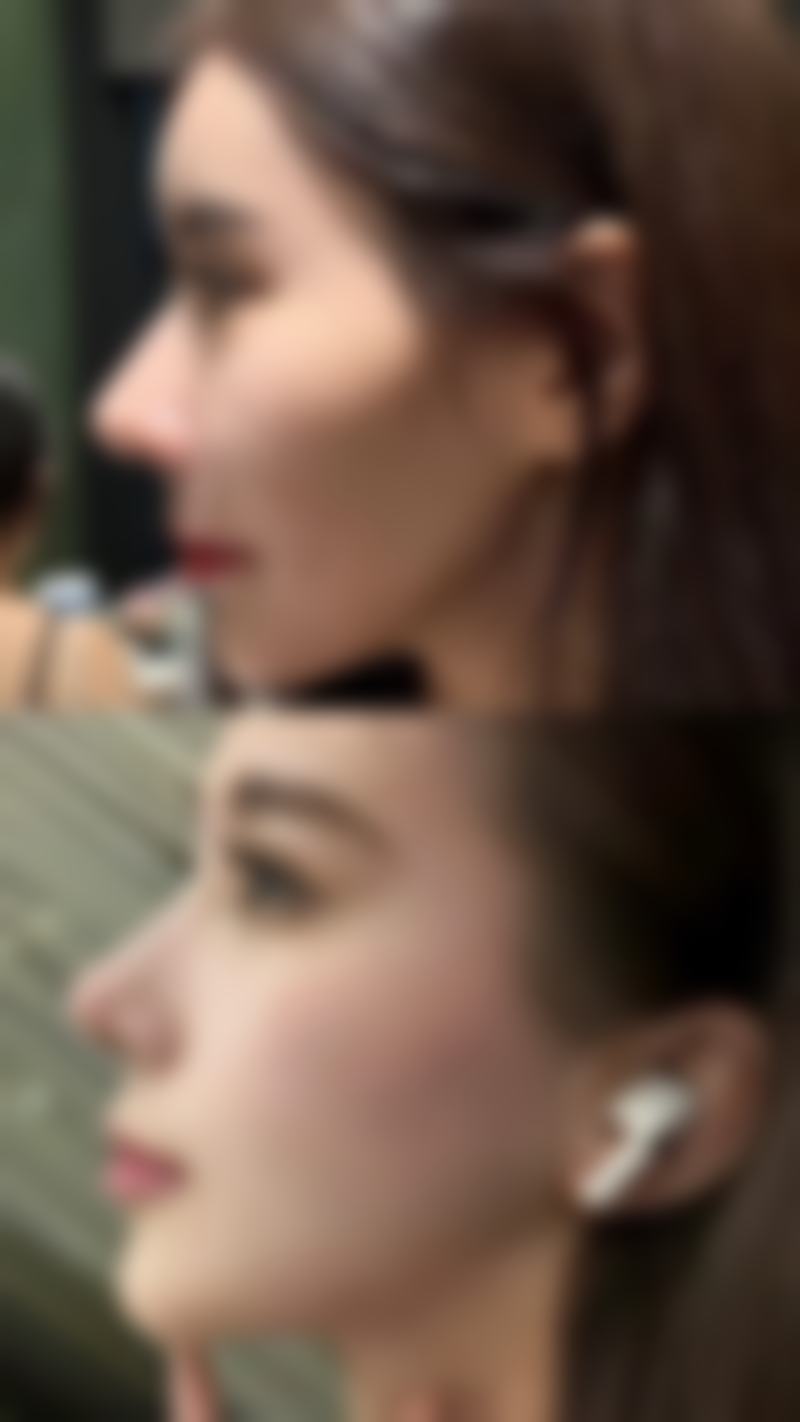 【哈尔滨诺嬄美医疗美容门诊部参考价格表：】