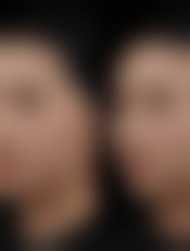 【宸山医疗美容集团患者口碑评价：】