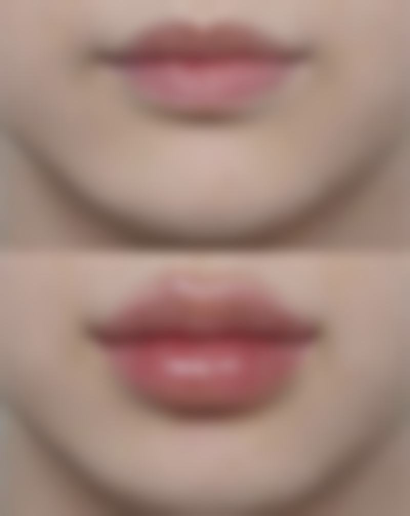 针灸除皱有成效吗