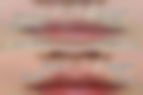 嘴型不好看怎么办女生