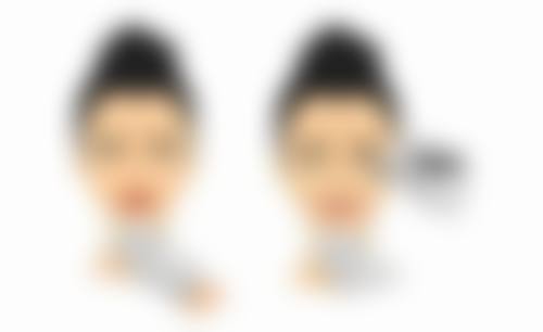 嘴型不好看怎么办图片