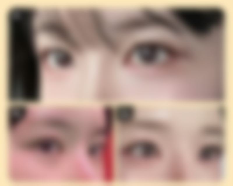 国产瘦脸针成效明显吗