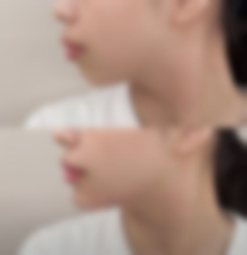 毛发种植比较好的医院