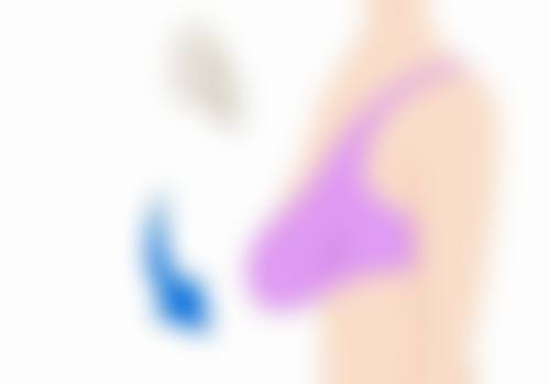 打完瘦脸针脸僵硬多久能修复