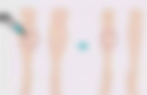 除皱打多了怎么快速代谢出去