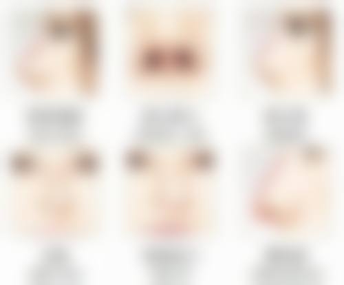 打完瘦脸针面部僵硬多久能修复正常饮食