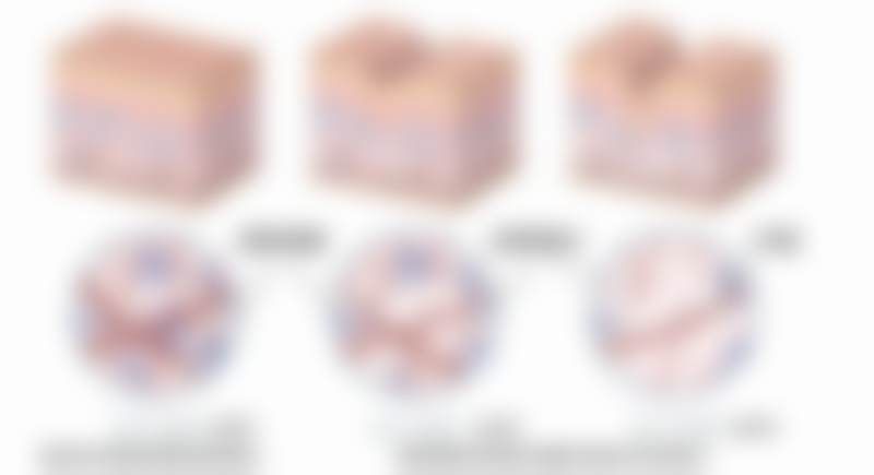 广州高尚医学美容中 心栾翰林技术适合哪些人群