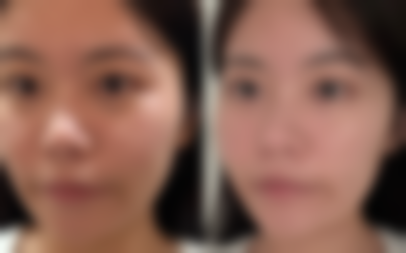 【胡晓焕医生口碑怎么样？】