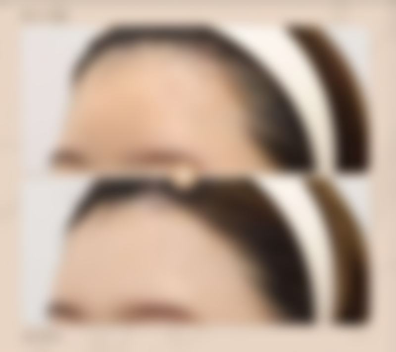 【长沙天一美容整形医院是正规的吗?】