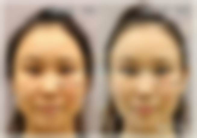 北京客来美舍医疗美容诊所江会芳擅长项目，揭秘她打造的3大热门医美项目，真能让你年轻10岁？ 