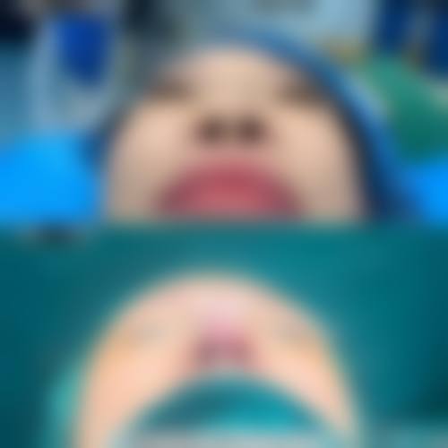 【合肥壹加壹整形美容医院有限公司滨湖门诊部参考价格表：】