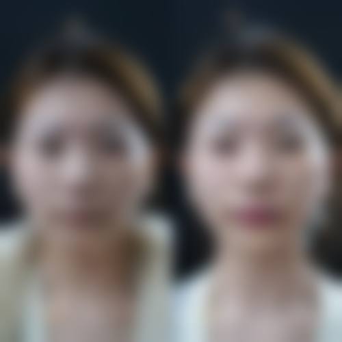 【重庆军科私密整形医院参考价格表：】