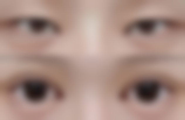 大连润德心动医疗美容诊所引进了一系列国内外有名公司的高、尖、精设备。这些设备就像是诊所的秘密武器，为医疗美容服务的专精性和安心性提供了有力保护。比如精良的激光设备，它可以精细地作用于皮肤的不同层次，对于去除色斑、改善皮肤纹理等都有良好的成效。还有高端的整形手术设备，能够让医生在手术过程中更加精细地操作，减少手术风险，提高手术的成功几率。这些设备的看诊优势在于它们的精细性、效率高性和安心性，能够为顾客带来更好的美容体验。