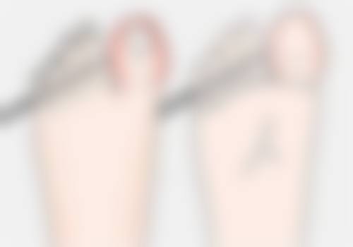 丰太阳穴适合哪种方法