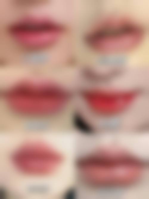 益阳明瑞医疗美容医院的特色项目有眼鼻整形、丰胸、吸脂、注射美容、皮肤治疗、微针、激光、脱毛等。这些项目可以满足不同顾客对于美的追求，无论是想要改善面部五官，还是塑造理想身材，亦或是解决皮肤问题，都能在这里找到适合自己的项目。