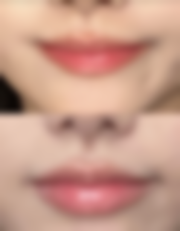 2. 我来这里做皮肤治疗，之前脸上有特别多色斑，尝试了特别多方法都没有成效。在益阳明瑞经过几次激光治疗后，色斑明显淡化了。医生会根据我的皮肤状况调整治疗方案，特别负职责。而且医院的环境特别舒适，让人感觉特别放松。