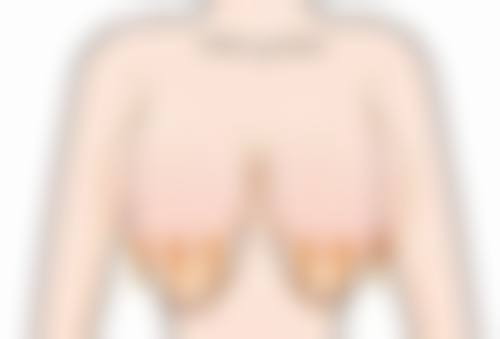 【Henri Clinic 名古屋院参考价格表：】