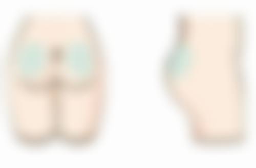 瘦脸针去哪里打、瘦脸针在哪里打