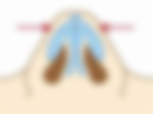 如何选择适合自己的瘦脸针品牌