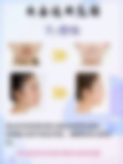 宽脸适合做什么样的双眼皮？