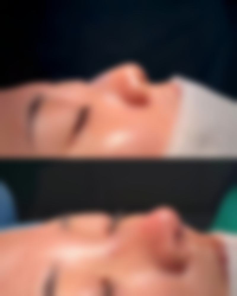 宽脸瘦了好看吗？
