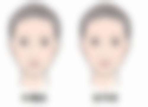 种植过后的头发是不是也容易脱落