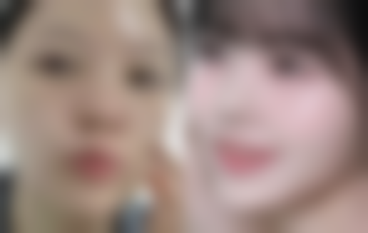 【曹林医生技术特点】